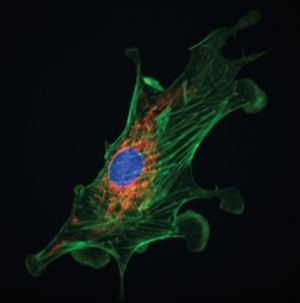  (foto di fibroblasto con la miscopia a fluorescenza 