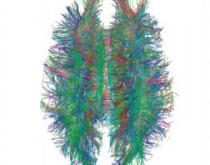 White Matter Connections White Matter Connections