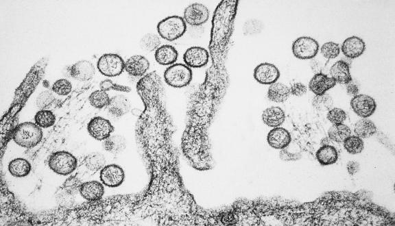 Hantavirus