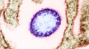 virus Nipah al microscopio