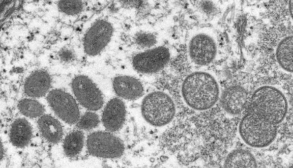 Immagine ingrandita del virus MPXV