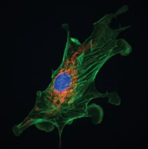 (foto di fibroblasto con la miscopia a fluorescenza (foto di fibroblasto con la miscopia a fluorescenza