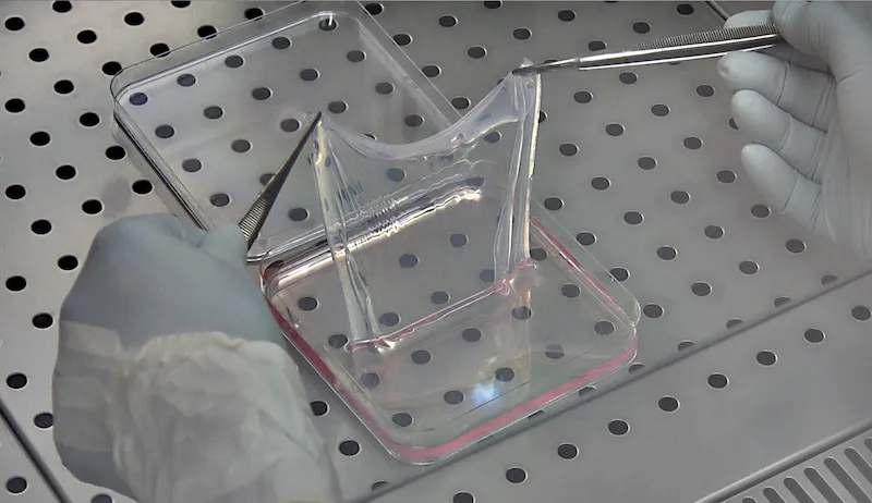 Lembo di epidermide coltivata su fibrina