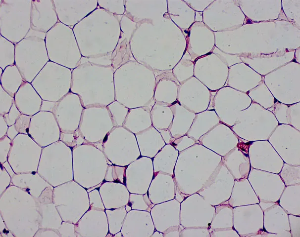 Un’immagine del tessuto adiposo bianco (WAT) caratterizzato da cellule di grandi dimensioni contenenti grosse gocce lipidiche che occupano la maggior parte del citosol in cui i…