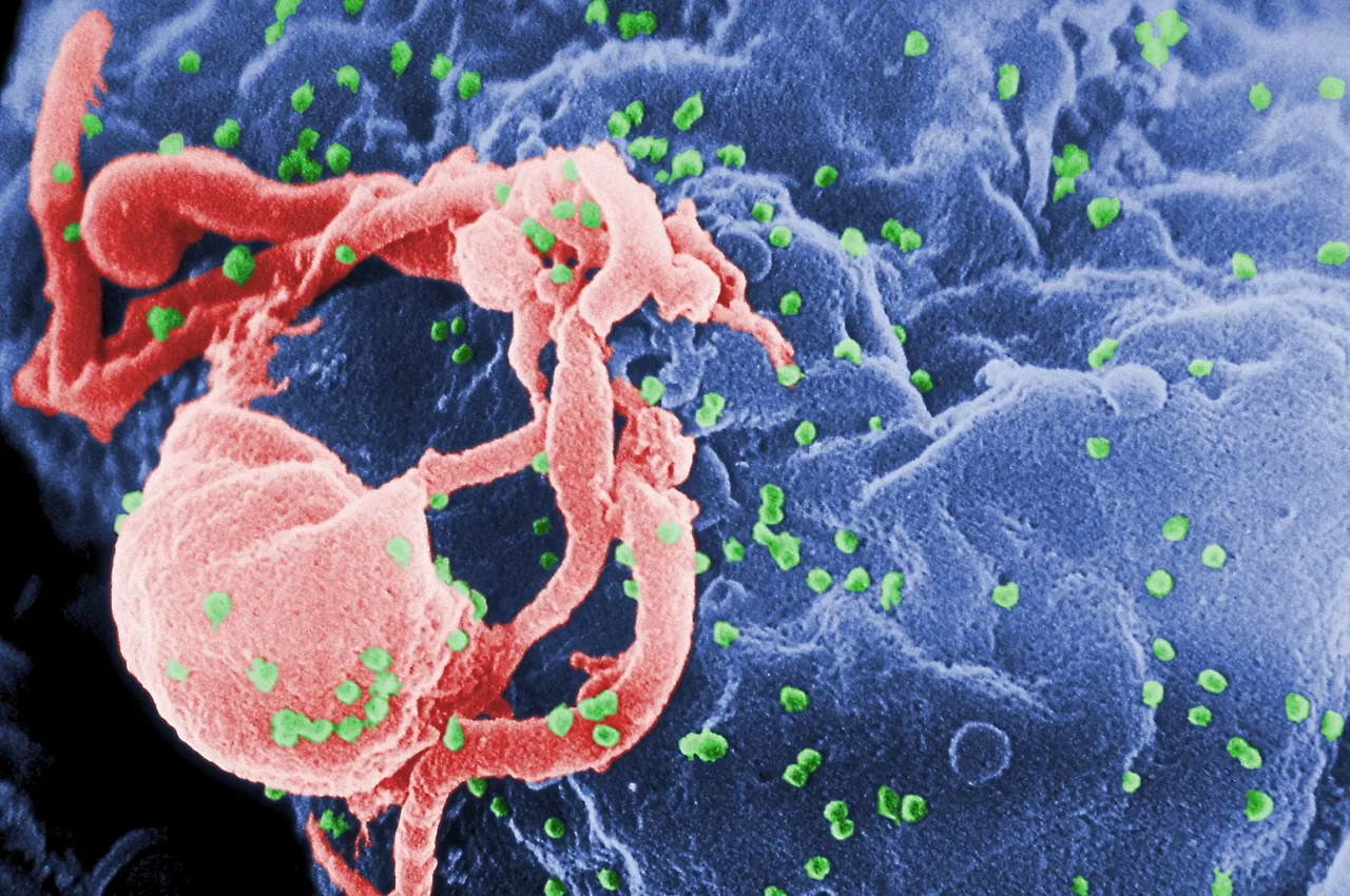 Scanning electron micrograph of HIV-1 budding