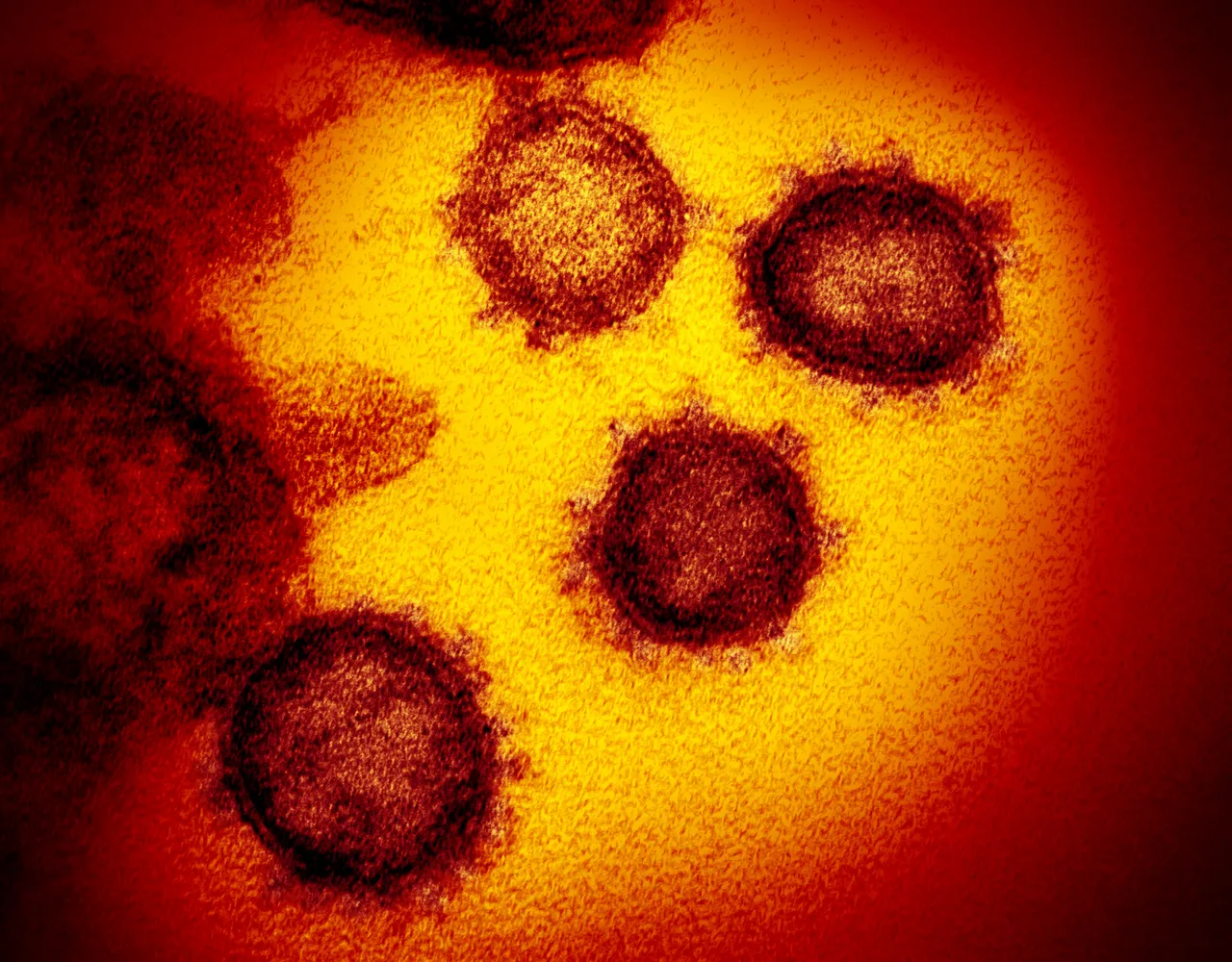 Particelle del virus SARS-CoV-2 al microscopio elettronico, sferiche e scure su fondo giallo e arancione.
