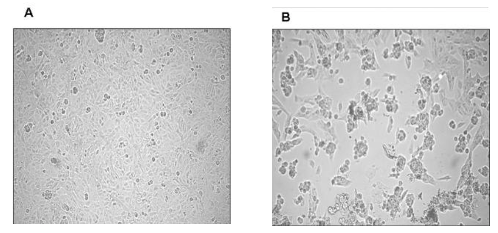 Effetto citopatico del SARS-CoV (coronavirus) su cellule VERO. Il tappeto di cellule affusolate non infettate (A) subisce un profondo cambiamento morfologico associato a morte cellulare indotto dall’infezione virale. Da: E. Vicenzi et al., Emerging Infectious Diseases, 2004