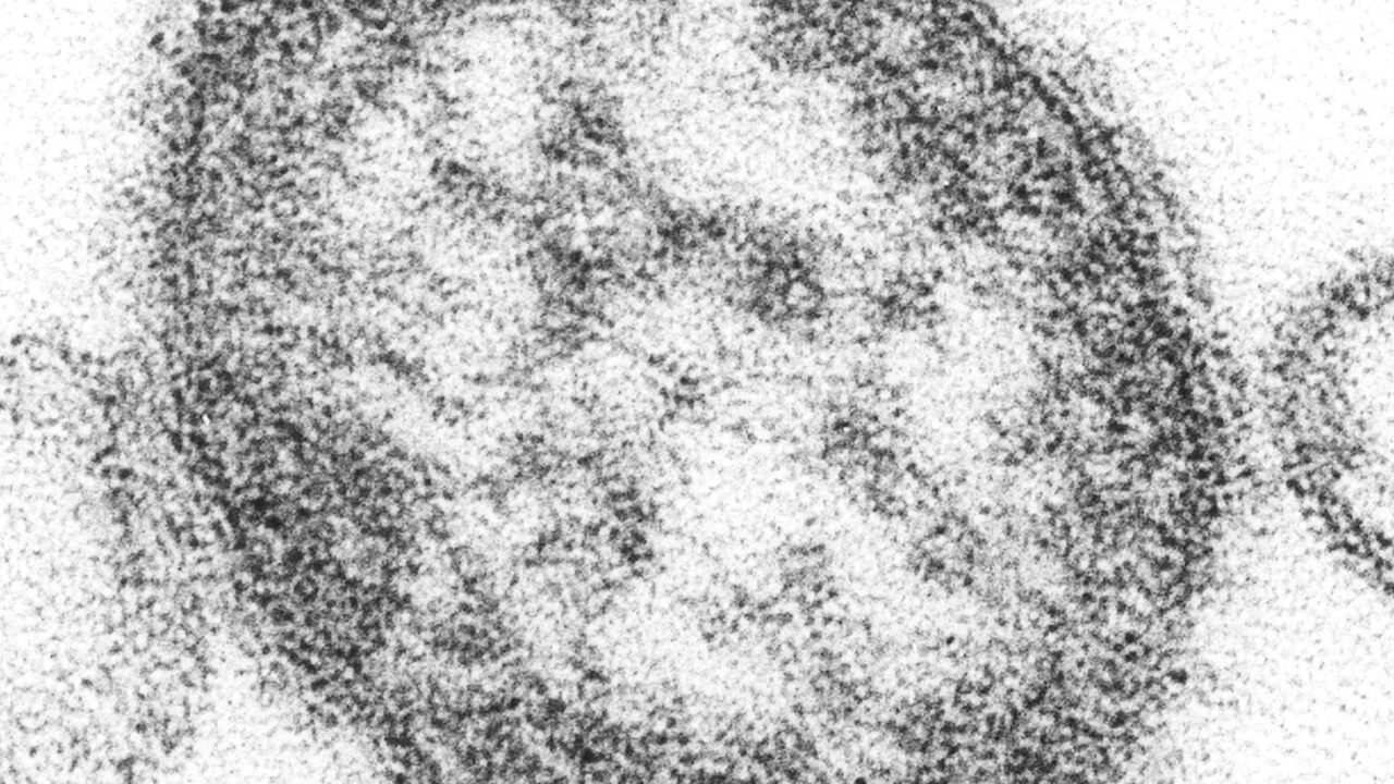 virus del morbillo al microscopio elettronico