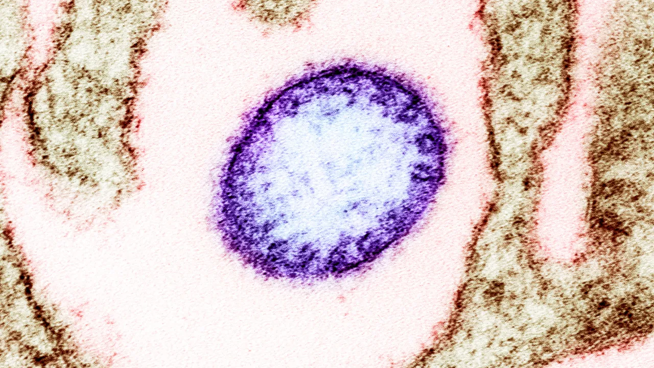 virus Nipah al microscopio