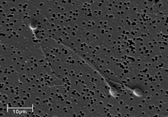 spermatozoi