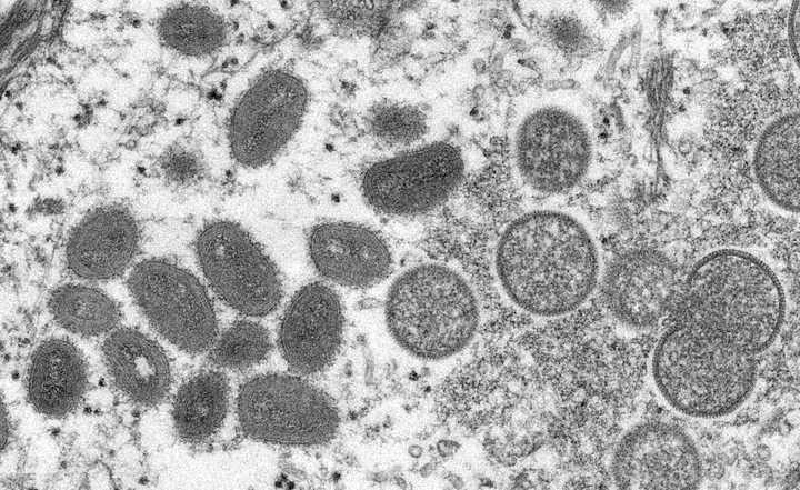 Immagine ingrandita del virus MPXV