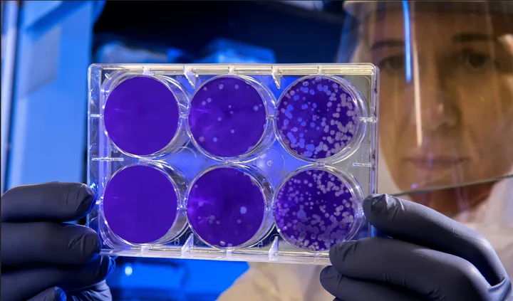 Una ricercatrice osserva in controluce alcune piastre di Petri in un laboratorio scientifico