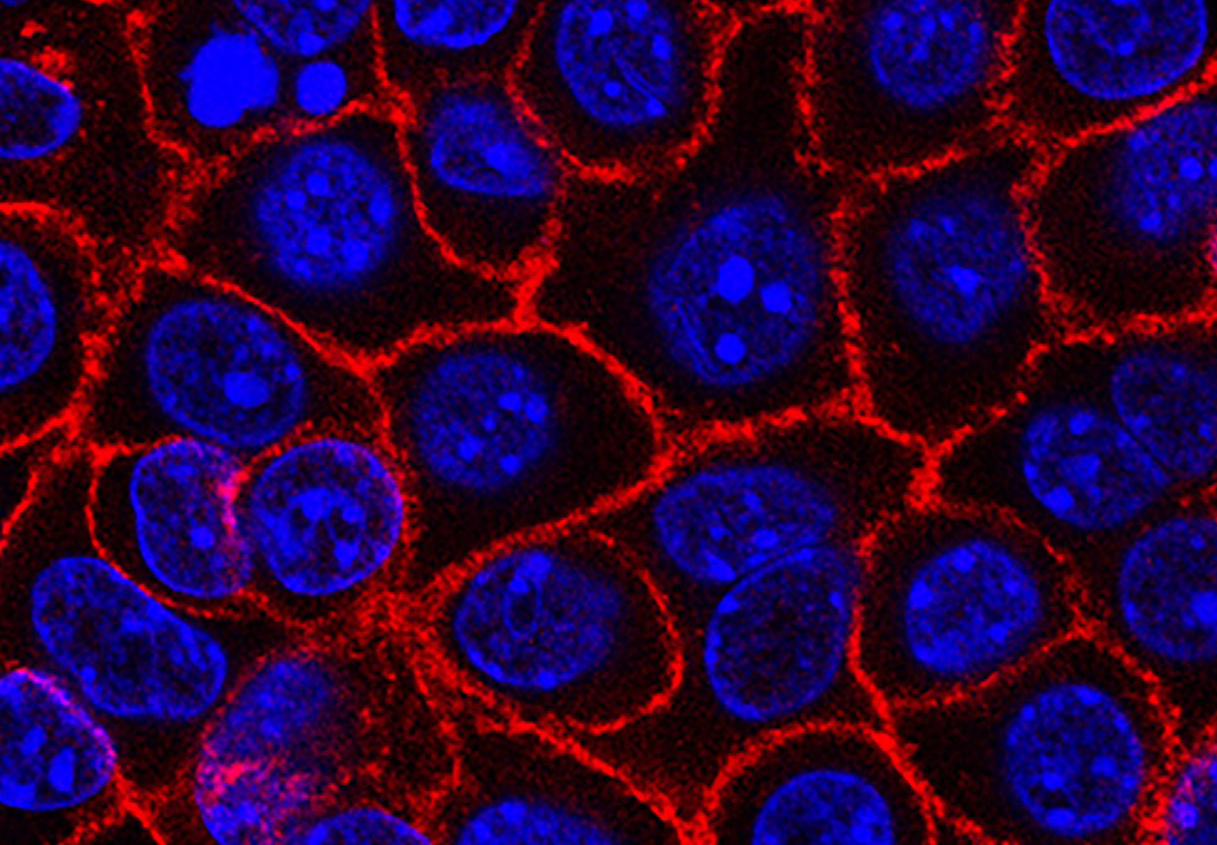 Particolare di un gruppo di cellule tumorali nel pancreas cresciute in laboratorio nuclei cellulari in blu, mebrane in rosso). Credit: Min Yu / National Cancer Institute, USC Norris Comprehensive Cancer Center. Licenza: Public Domain. 